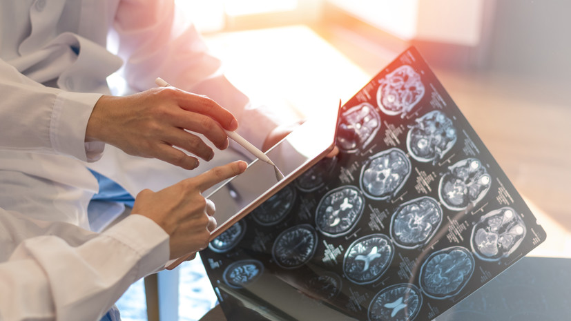 Врач Демьяновская перечислила ранние признаки склероза