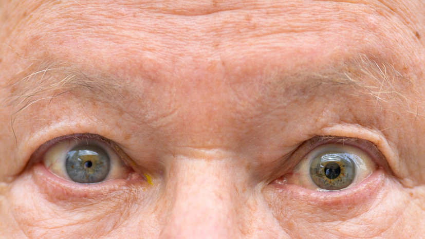 Офтальмолог Соловей перечислила причины анизокории