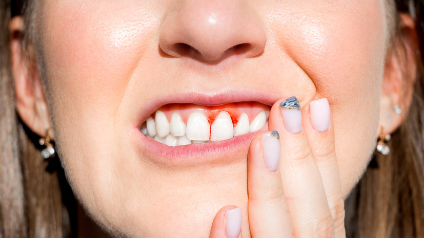 Стоматолог Морозова: пародонтит может развиться из-за патологии прикуса