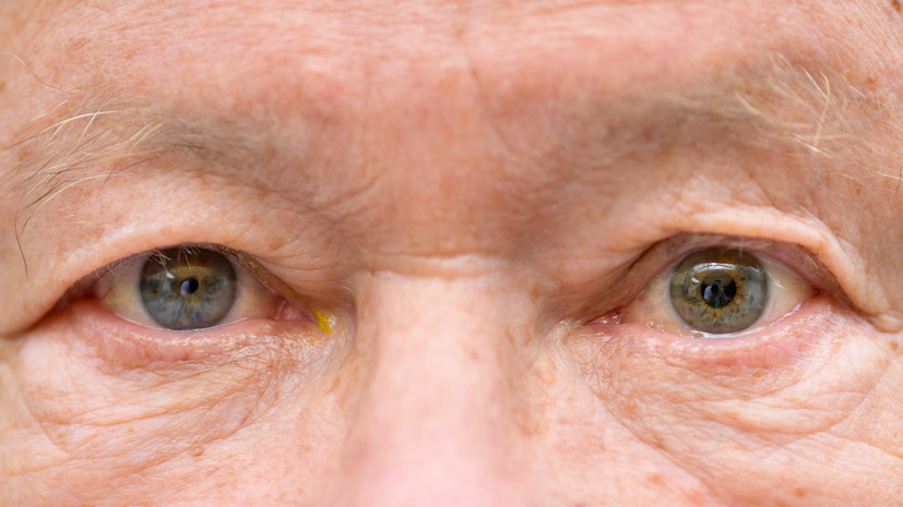 Офтальмолог Соловей: разные размеры зрачков не являются отдельным заболеванием