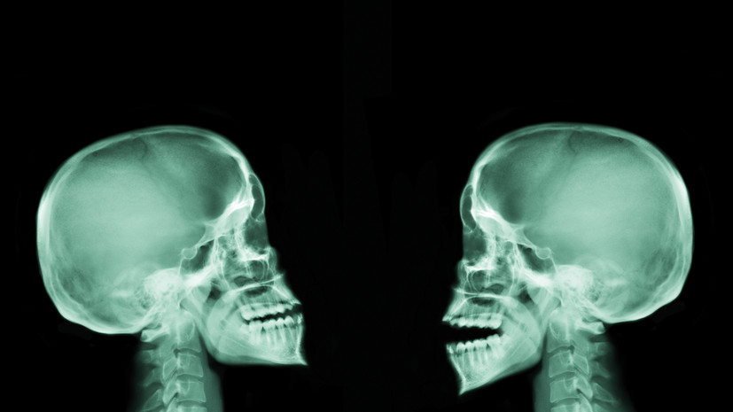 Ортодонт Радько посоветовала не игнорировать щелчки в челюсти