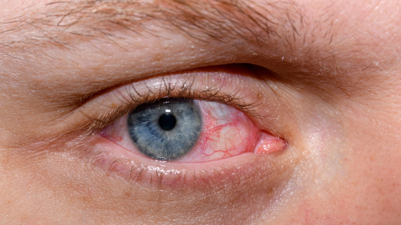 Терапевт назвала кашель и покраснение глаз признаками отравления хлором в бассейне