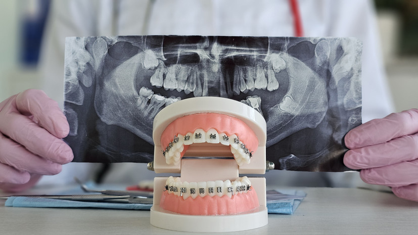 Стоматолог Кадыров: возраст не является противопоказанием для исправления прикуса