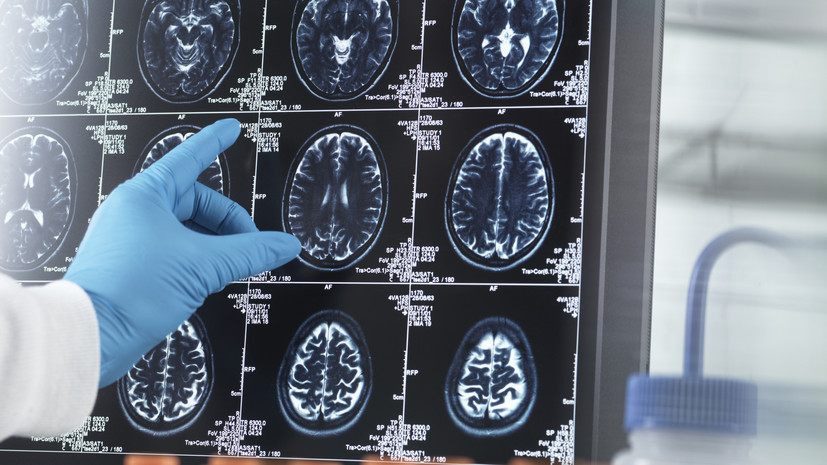 Врач Демьяновская рассказала о важности питания для профилактики деменции