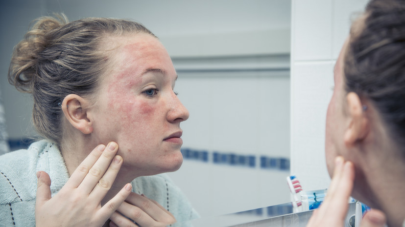 Эндокринолог Бинатова: на состояние кожи влияют быстрые углеводы