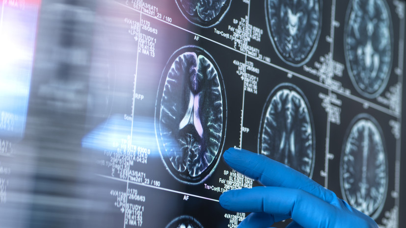 Невролог назвала ночные судороги признаком нарушений работы головного мозга