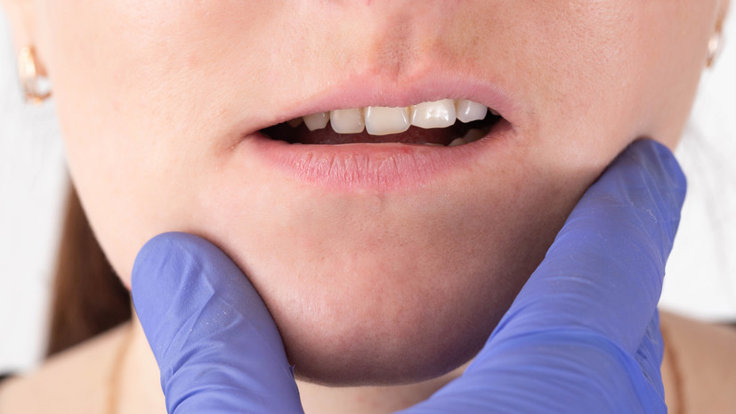 Ортодонт Радько: неправильный прикус может стать причиной развития гайморита