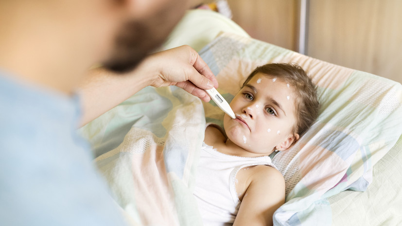 Терапевт Чернышова: ветрянка начинается с повышения температуры тела