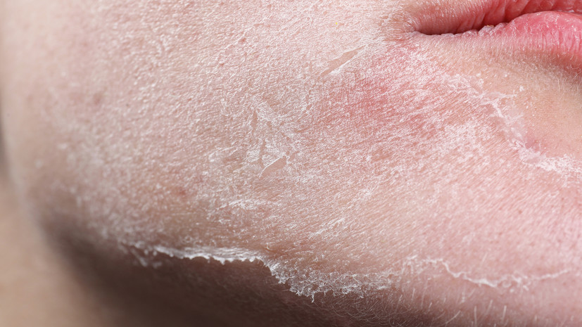 Косметолог Слободянюк рассказала о вреде домашних пилингов