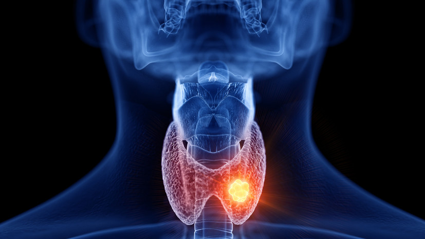 Врач Иваницкая посоветовала проверить щитовидную железу при резком изменении веса