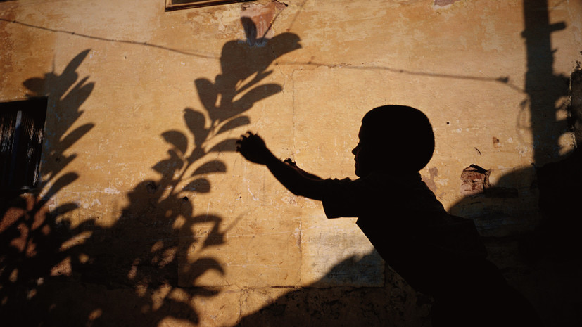 Педиатр Морозова: на ранних этапах синдром Кабуки можно принять за синдром Дауна