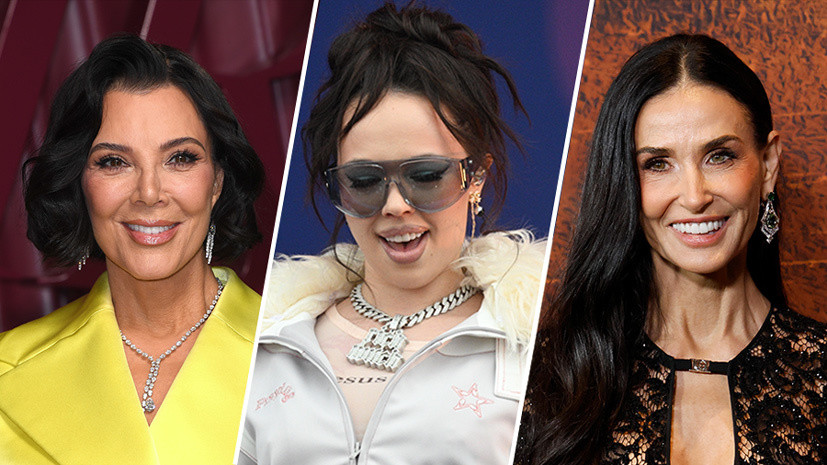 Нестареющие и неузнаваемые: как знаменитости преображаются с помощью пластики и косметологии