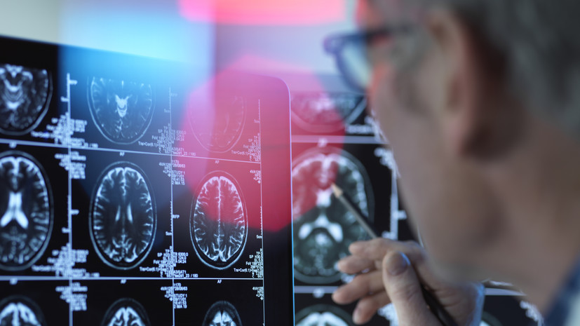 Врач Чердак: билингвизм может отсрочить развитие болезни Альцгеймера