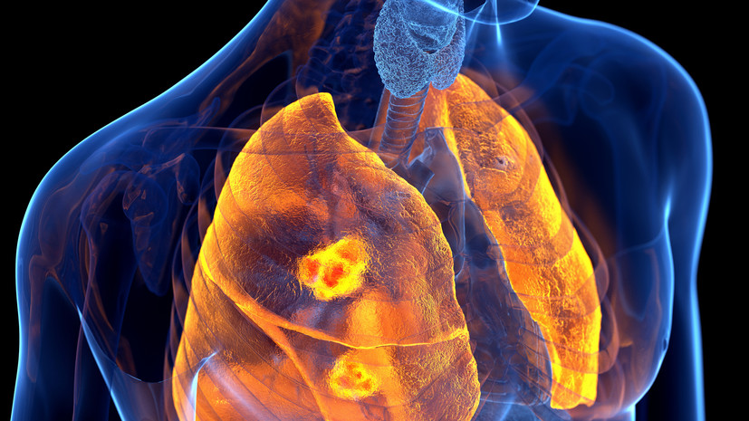 Специалист Буланов: симптомы ХОБЛ могут принять за усталость