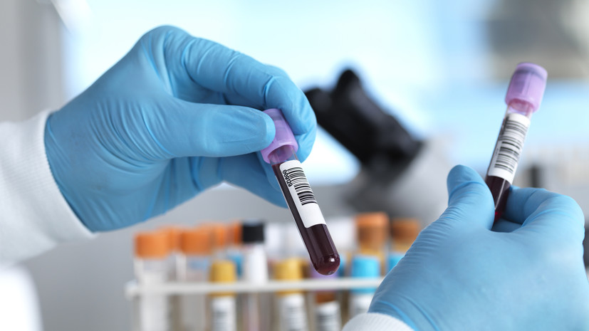 Врач Власова посоветовала сдать анализы на свёртываемость крови после 35 лет