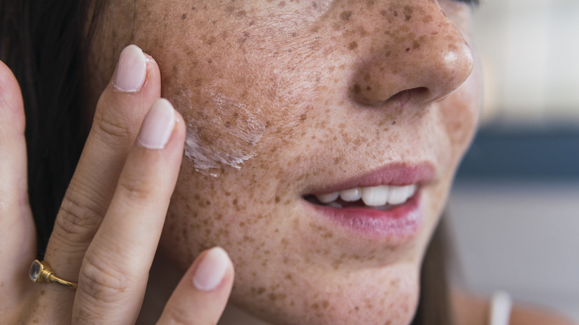 Дерматолог Иванова: один крем не поможет сухой коже