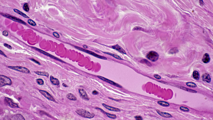 Трансфузиолог Трахтман назвал ключом к долголетию сохранение густой сети капилляров