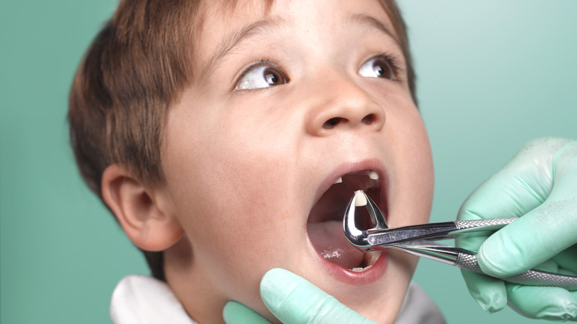 Врач рассказал о последствиях преждевременного удаления молочных зубов
