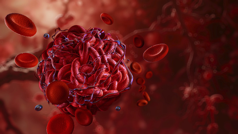 Врач Фролова: в сильный мороз повышается риск тромбоза