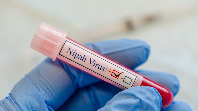 Инфекционист Никифоров заявил, что вирус Нипах не сможет вызвать эпидемию