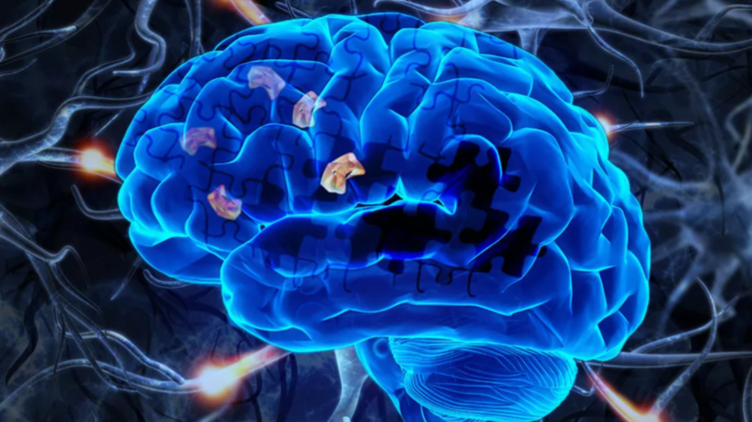 В России разработали тест-системы для раннего выявления болезни Альцгеймера