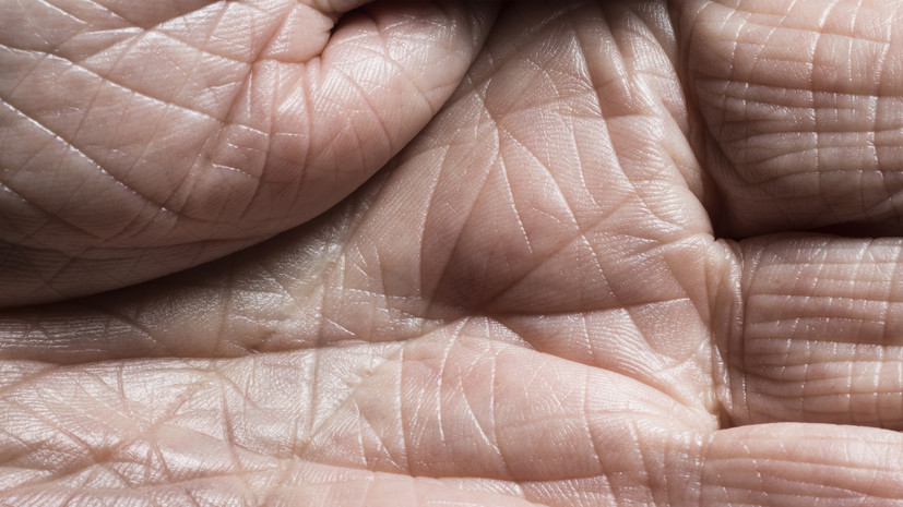 Дерматолог Котова объяснила, как распознать и вылечить обезвоженную кожу