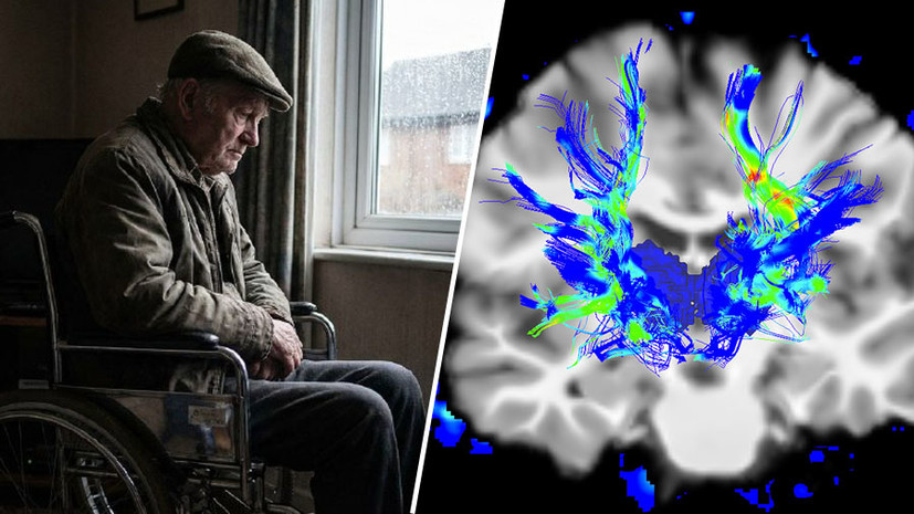 «Способны повреждать нервные клетки»: эксперты — о главных факторах развития болезни Паркинсона