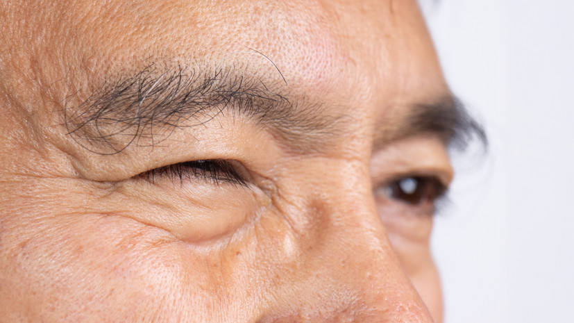 Офтальмолог Казанцев: подёргивание века чаще всего вызывает стресс и недосып