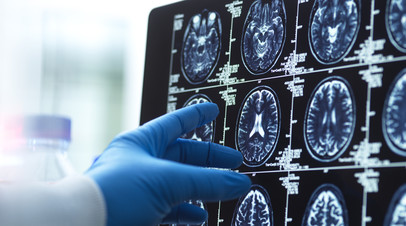 Невролог Хорошев рассказал, как не пропустить первые признаки деменции