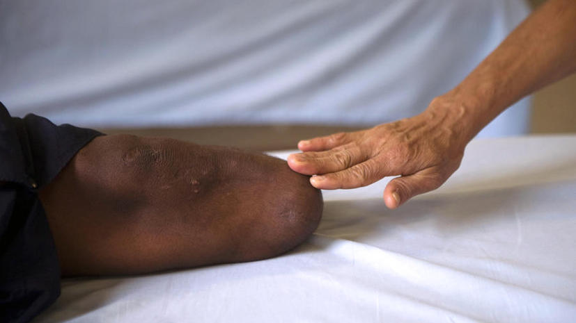 Китаец, не имея денег на операцию, сам ампутировал себе ногу