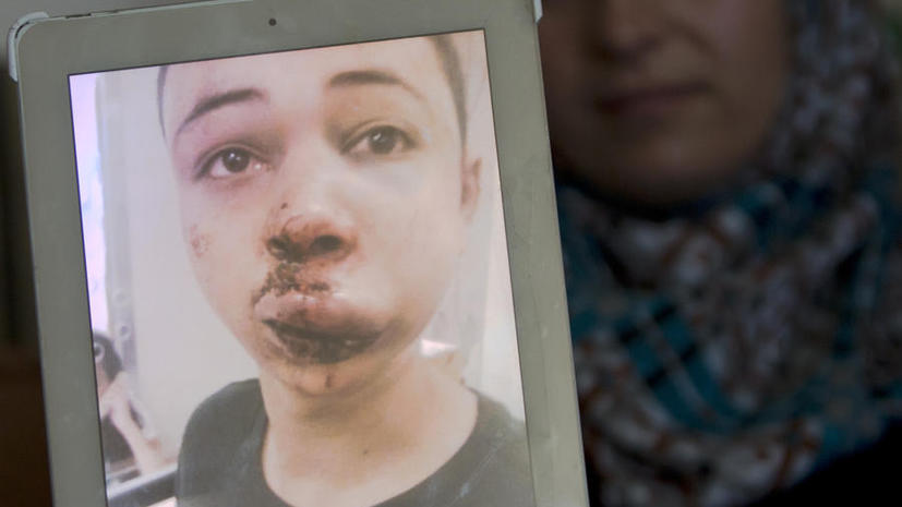 Израильские полицейские жестоко избили двоюродного брата палестинского подростка, убитого радикалами